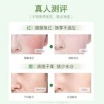 Yitong Squalane Panthenol Facial Cream – Hydrating, Moisturizing, Gentle Barrier Repair for Sensitive Skin - Image 2
