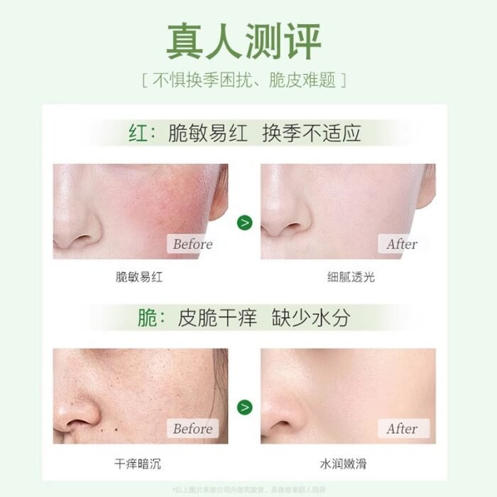 Yitong Squalane Panthenol Facial Cream – Hydrating, Moisturizing, Gentle Barrier Repair for Sensitive Skin - Image 2